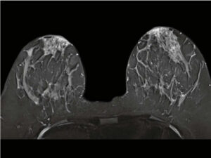 MRI Image