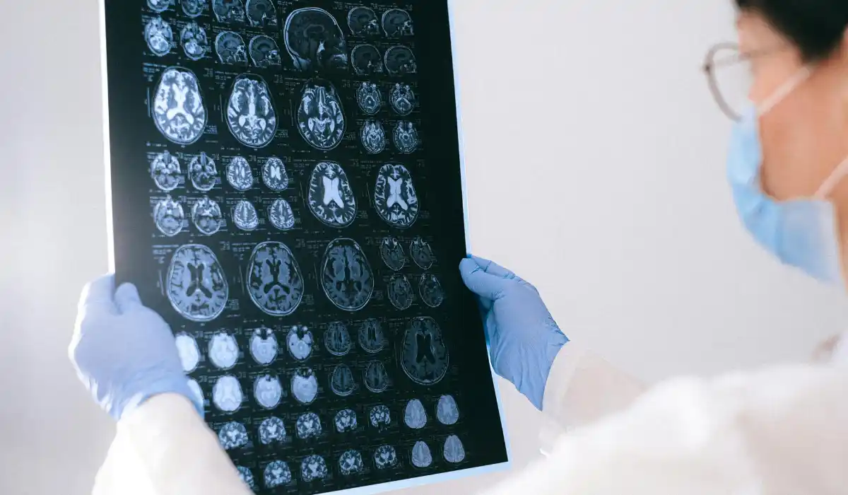 CT SCAN