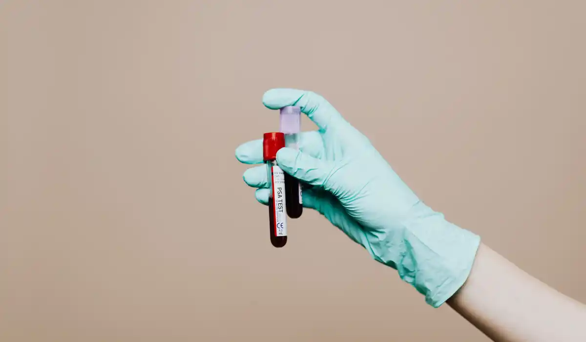 How to Lower PSA Before Test