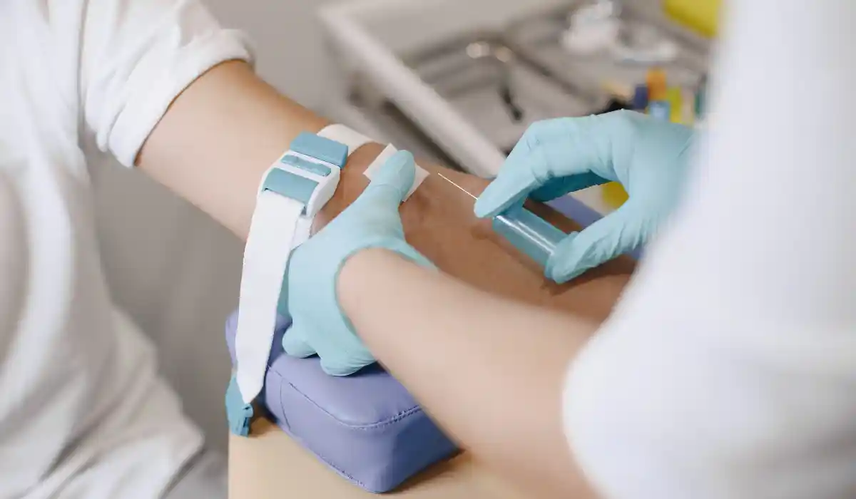 Things to Avoid Prior to PSA Test
