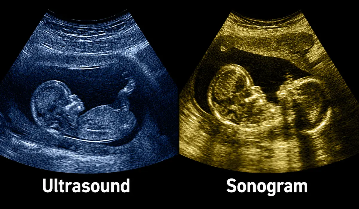 sonogram vs ultrasound
