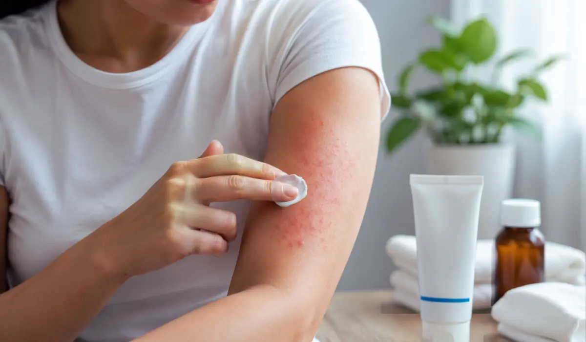 parasitic skin infection treatment